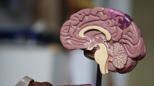 Tracking Brain Health to Detect Alzheimer’s